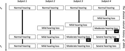 Making the Case for Research on Disease-Modifying Treatments to Tackle Post-lingual Progressive Sensorineural Hearing Loss